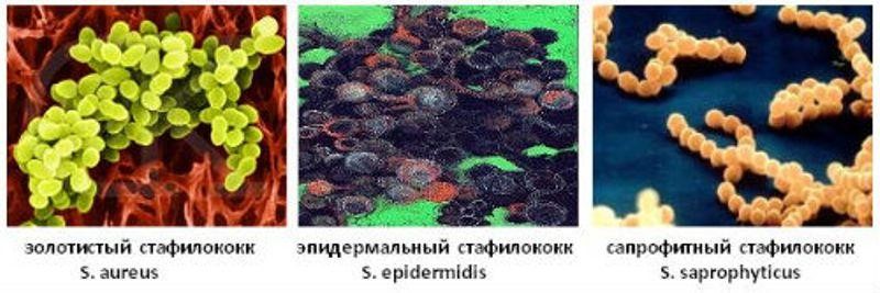 Стафилококки под микроскопом